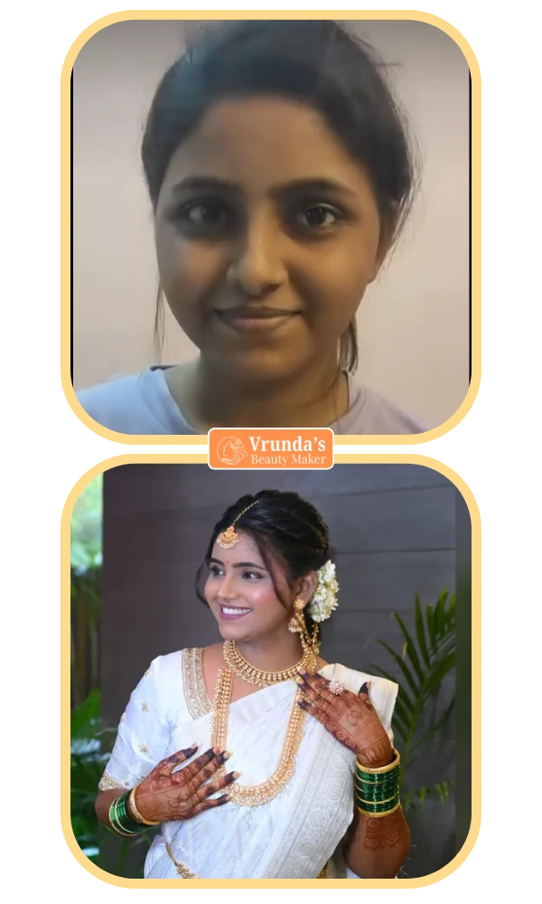 vrunda bm before and after